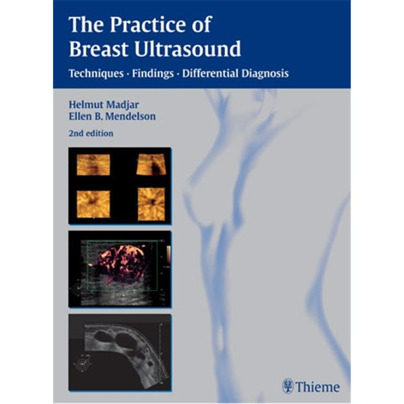 The Practice of Breast Ultrasound
